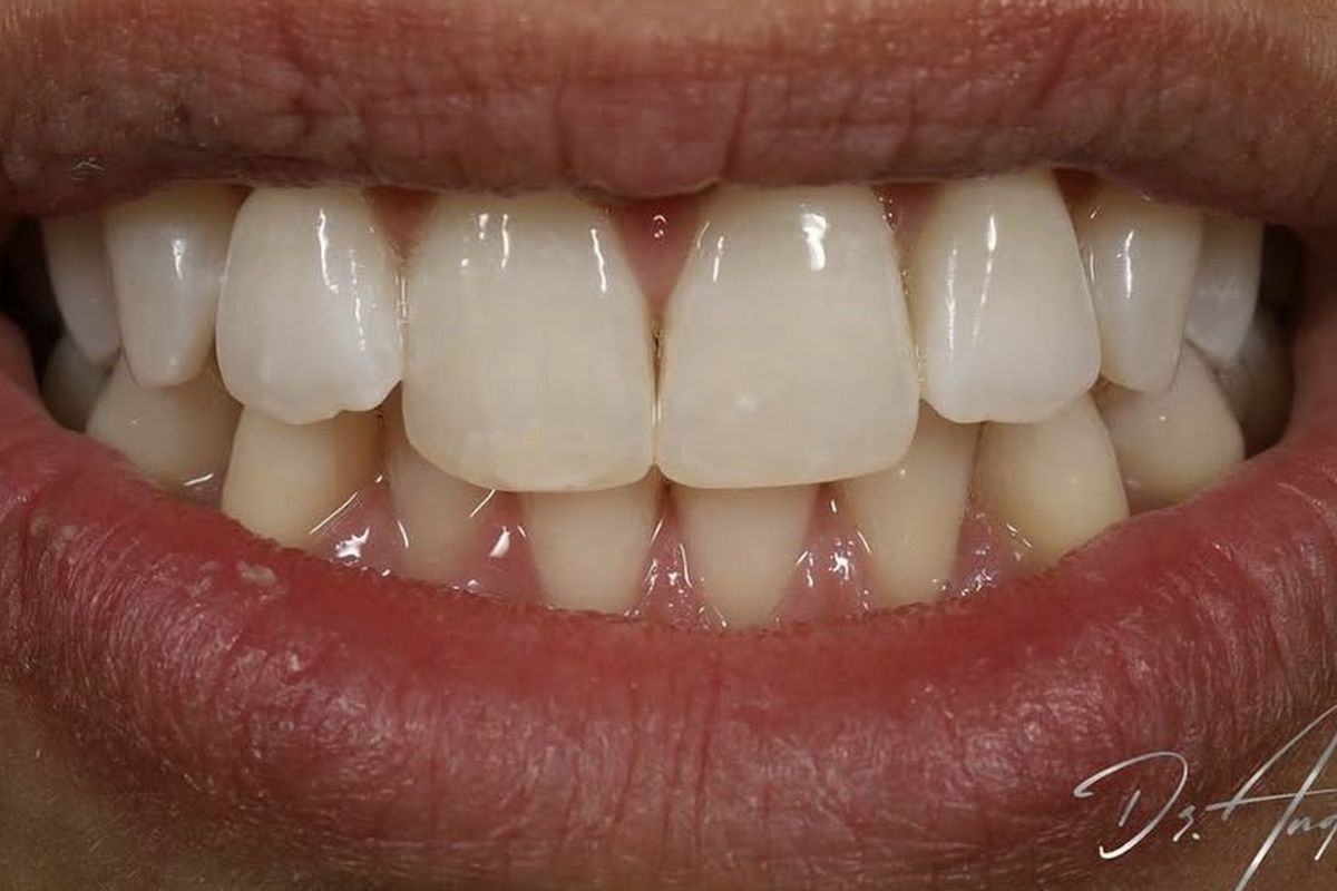 Natural results &mdash; after