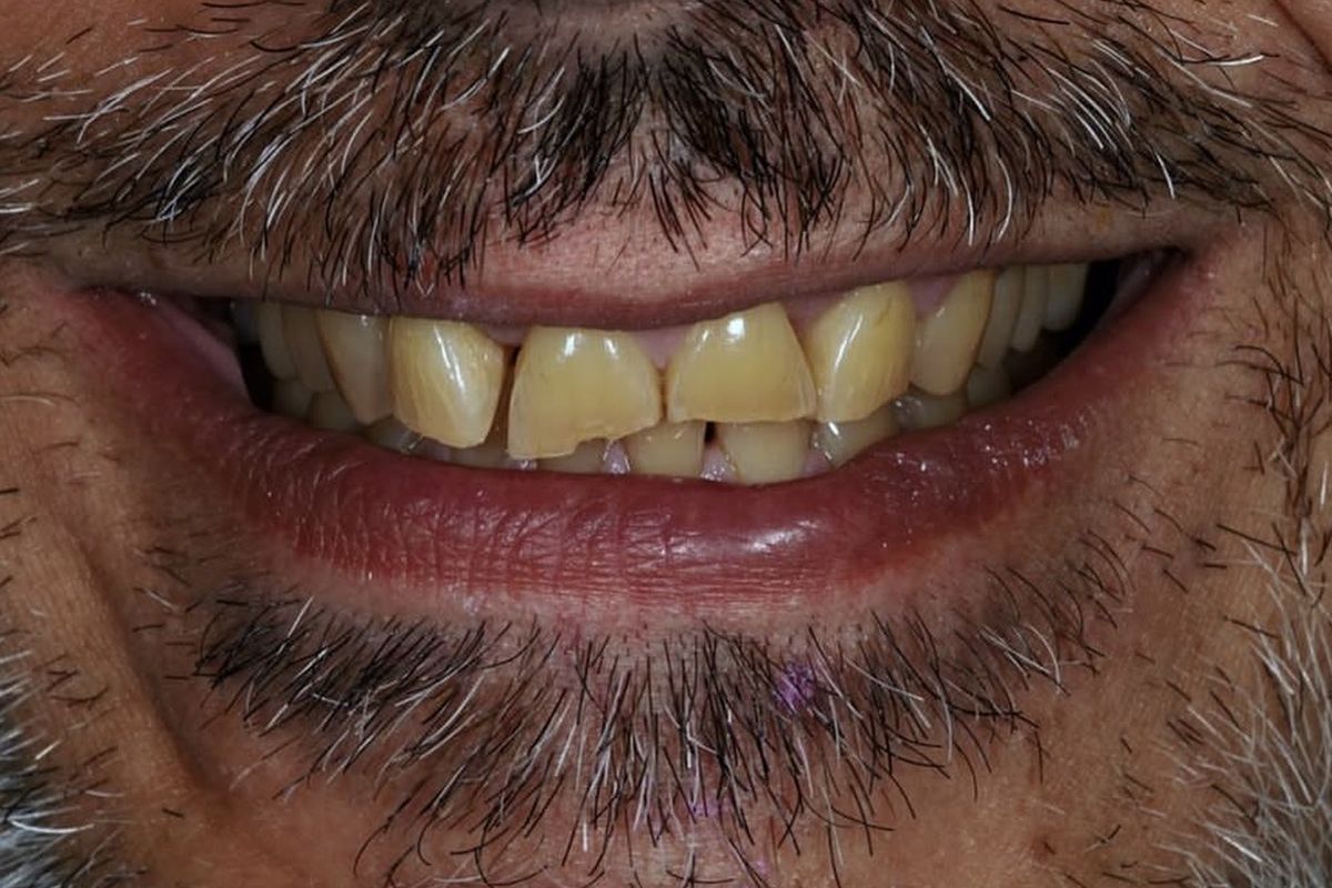 Patient's smile before treatment