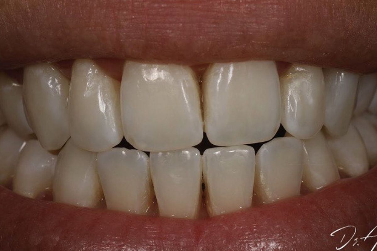 One smile at a time — after treatment by Dr Andreas Varianos
