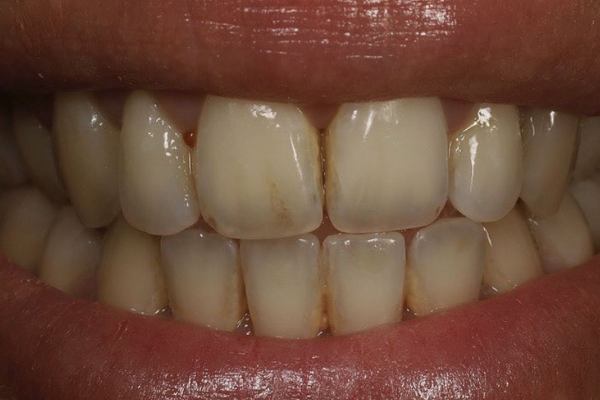 One smile at a time — before treatment