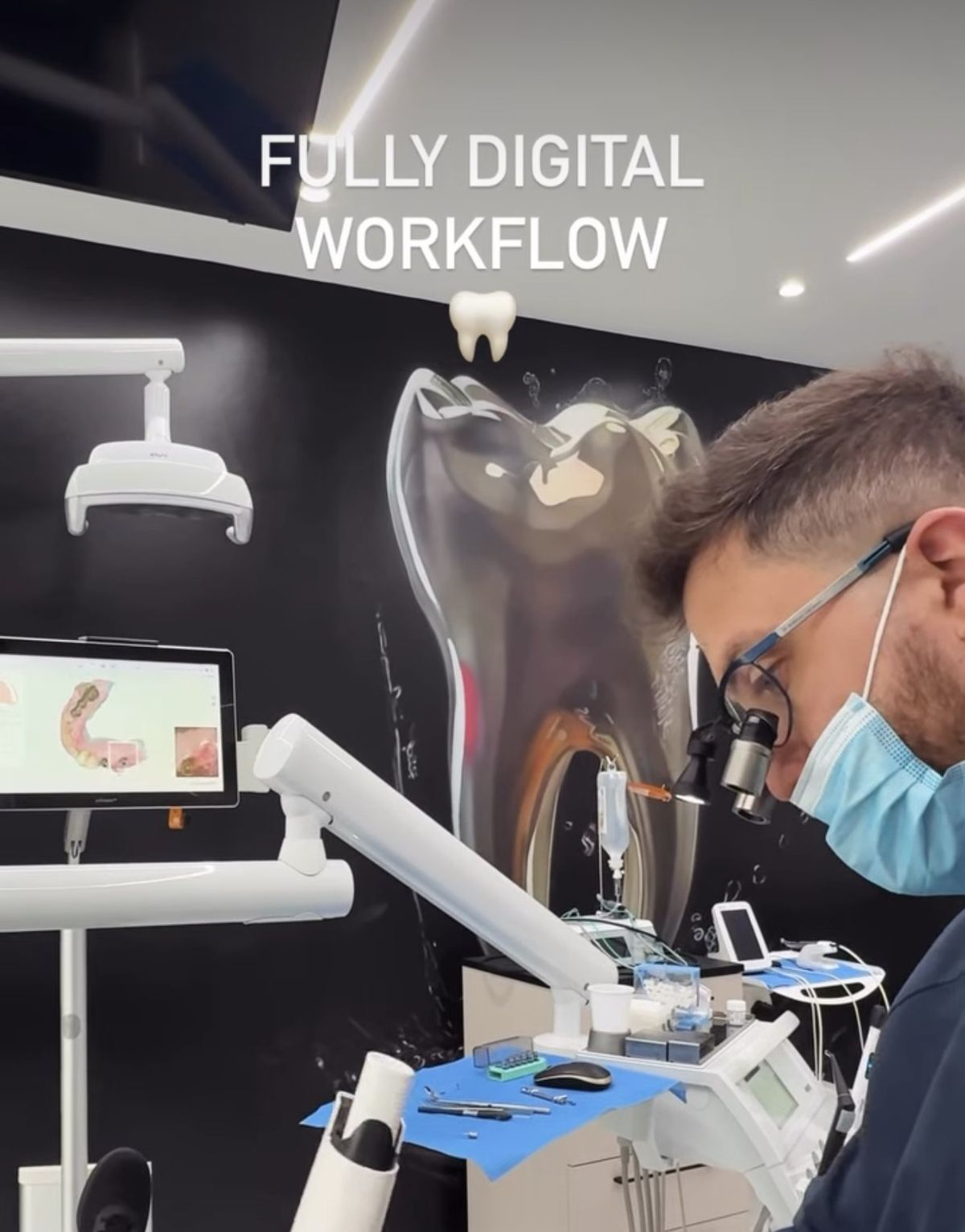 Digital scanning and treatment planning in the surgery