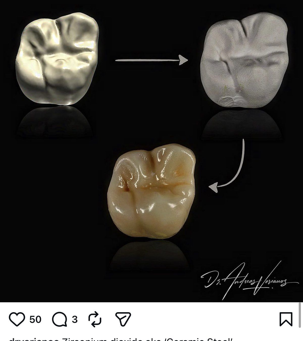 Zirconia crown, machined and characterised